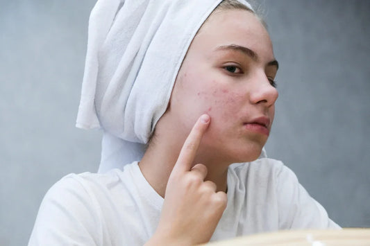Complete Acne Care Guide: Traditional Treatments, Side Effects & the Science of LED Light Therapy